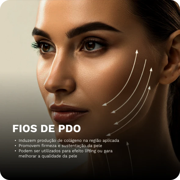 fios-de-PDO.webp