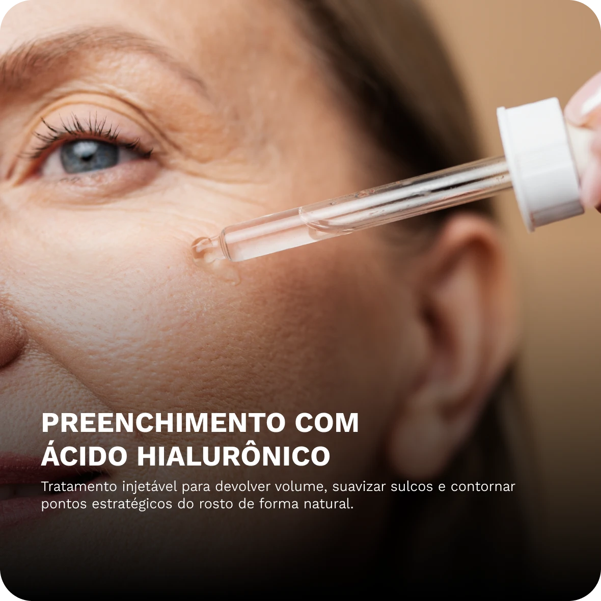 preenchimento acido